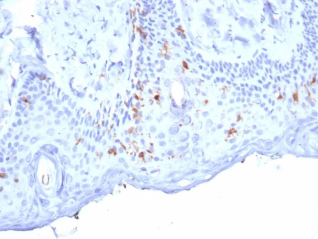 Langerin/CD207 (Marker of Langerhans Cells) Antibody in Immunohistochemistry (Paraffin) (IHC (P))
