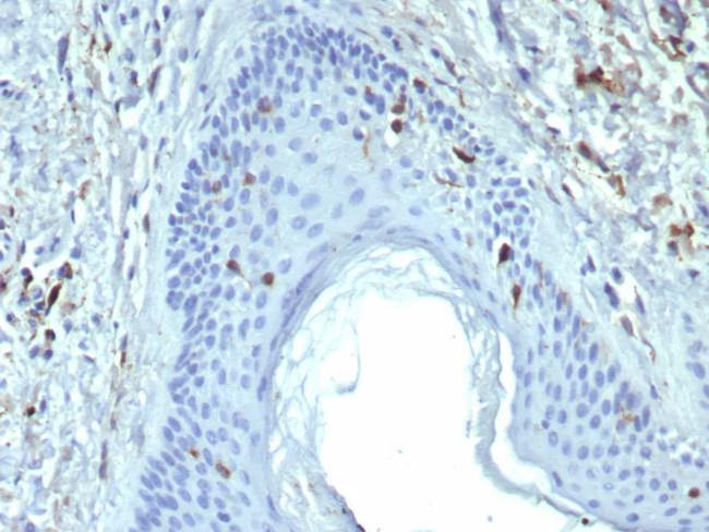 Langerin/CD207 (Marker of Langerhans Cells) Antibody in Immunohistochemistry (Paraffin) (IHC (P))