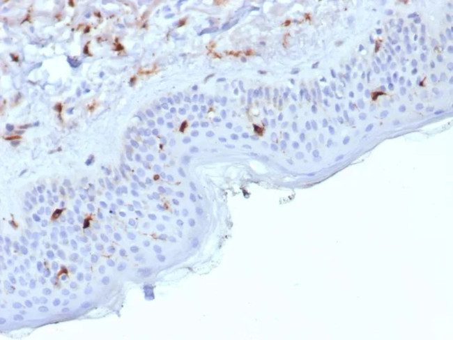 Langerin/CD207 (Marker of Langerhans Cells) Antibody in Immunohistochemistry (Paraffin) (IHC (P))