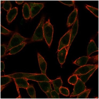 NEUROG3/Neurogenin 3/NGN3 (Transcription Factor) Antibody in Immunocytochemistry (ICC/IF)