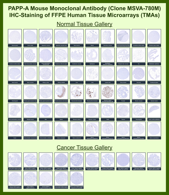 PAPP-A/Pappalysin-1 (Marker of Atherosclerosis and Aneuploid Fetus) Antibody in Immunohistochemistry (Paraffin) (IHC (P))