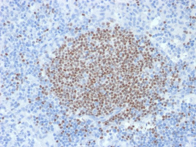 PAX5/BSAP (Early B-Cell Marker) Antibody in Immunohistochemistry (Paraffin) (IHC (P))