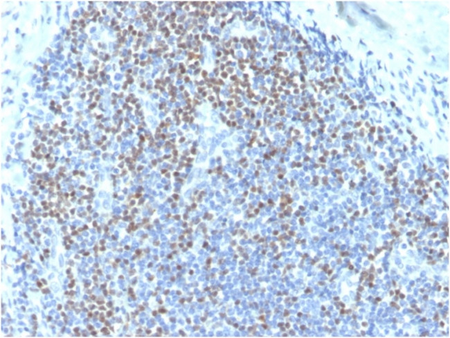 PAX5/BSAP (Early B-Cell Marker) Antibody in Immunohistochemistry (Paraffin) (IHC (P))