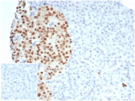 Pax Rabbit PAX6 (Stem Cell Marker) Recombinant Rabbit Monoclonal Antibody (PAX6 ...