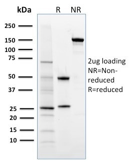 FOXP3 (Forkhead Box Protein P3)/Scurfin Antibody in SDS-PAGE (SDS-PAGE)