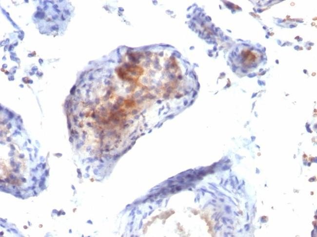 FOXP3 (Forkhead Box Protein P3)/Scurfin Antibody in Immunohistochemistry (Paraffin) (IHC (P))