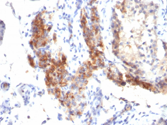 FOXP3 (Forkhead Box Protein P3)/Scurfin Antibody in Immunohistochemistry (Paraffin) (IHC (P))