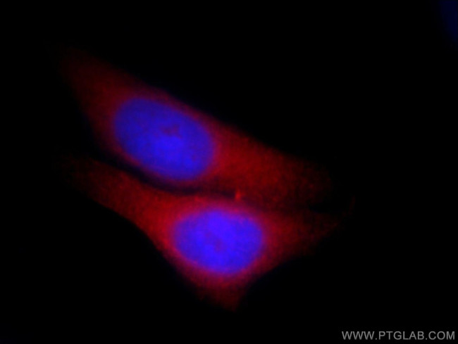 IST1 Antibody in Immunocytochemistry (ICC/IF)