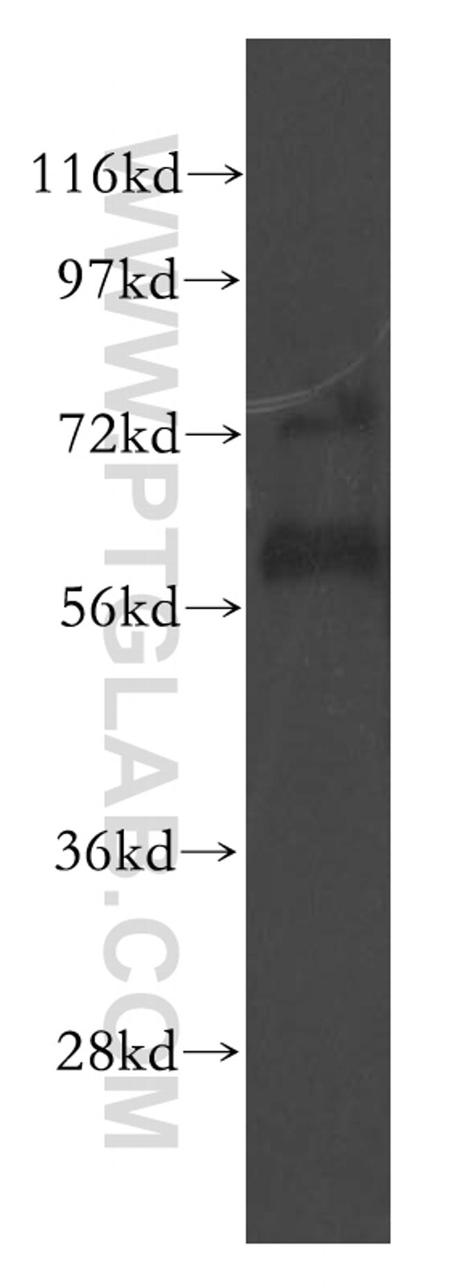 LYVE1 Antibody in Western Blot (WB)