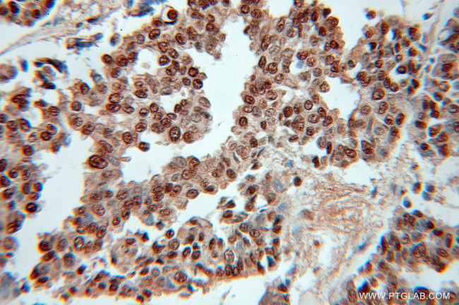 RPLP0 Antibody in Immunohistochemistry (Paraffin) (IHC (P))