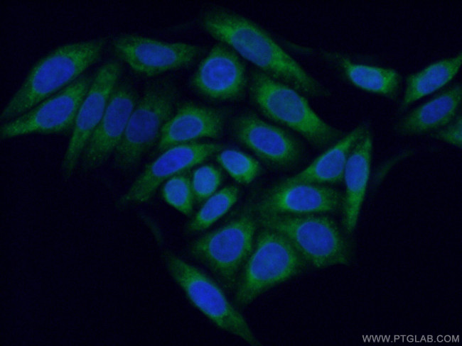 SEC61B Antibody in Immunocytochemistry (ICC/IF)