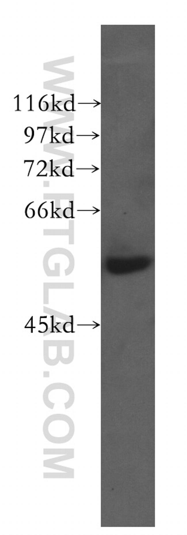 CTRP6 Antibody in Western Blot (WB)
