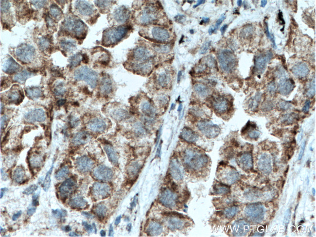 SLC25A6 Antibody in Immunohistochemistry (Paraffin) (IHC (P))