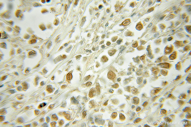 RAD23A Antibody in Immunohistochemistry (Paraffin) (IHC (P))