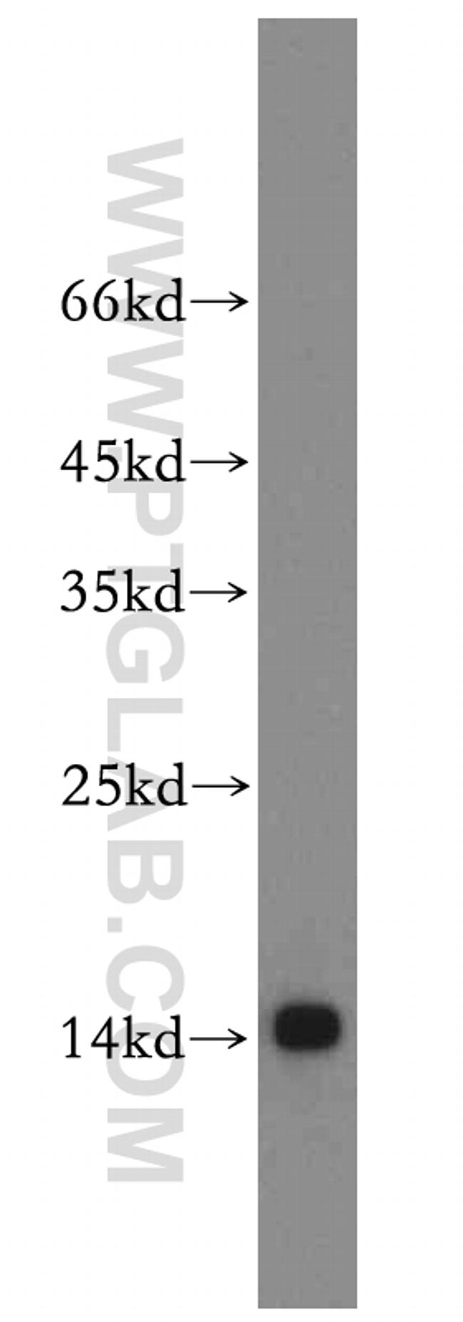 Fabp4 Antibody in Western Blot (WB)