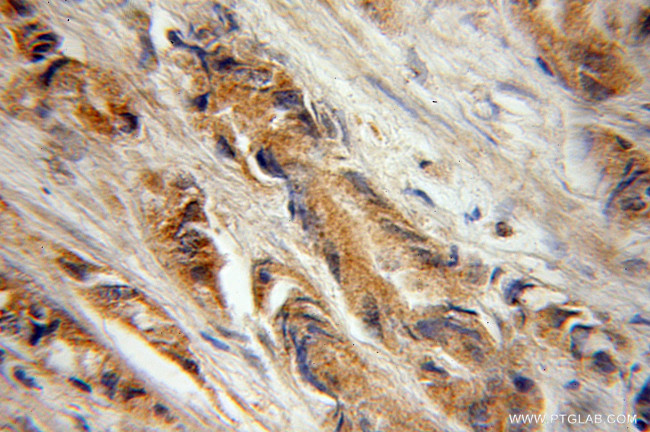 Galc Antibody in Immunohistochemistry (Paraffin) (IHC (P))