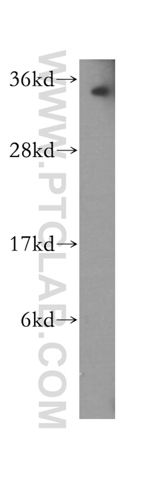 PNRC1 Antibody in Western Blot (WB)