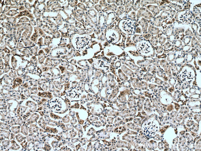 Myh9 Antibody in Immunohistochemistry (Paraffin) (IHC (P))
