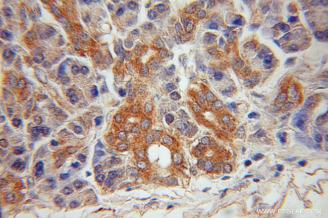 Jph2 Antibody in Immunohistochemistry (Paraffin) (IHC (P))
