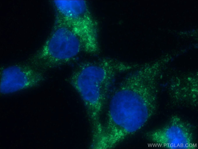NEK9 Antibody in Immunocytochemistry (ICC/IF)