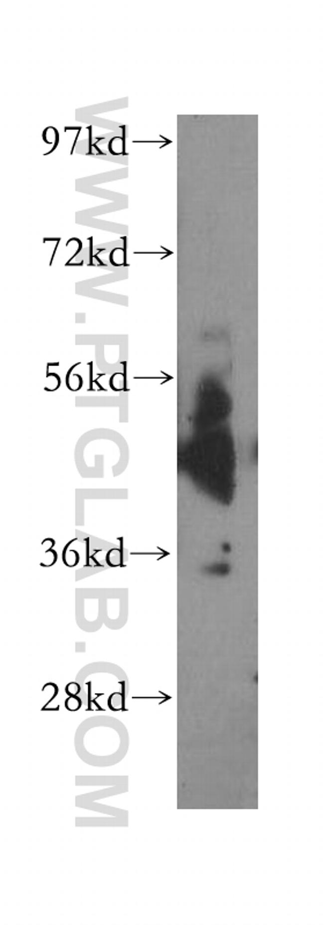 Cadm1 Antibody in Western Blot (WB)