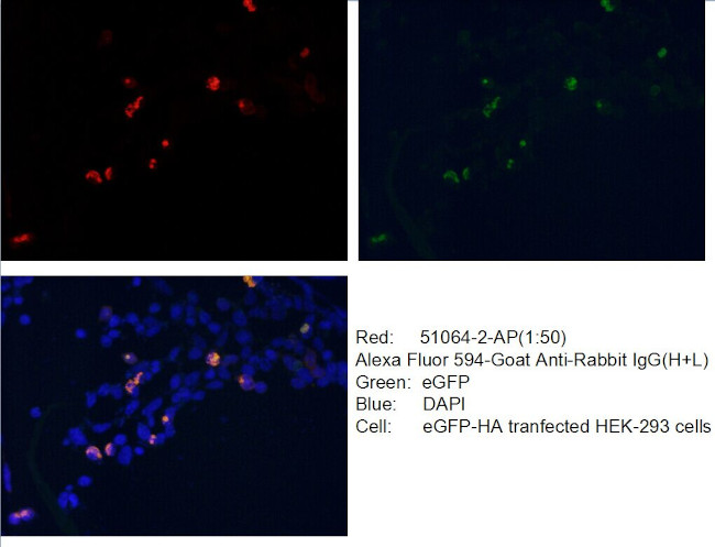 HA tag Antibody in Immunocytochemistry (ICC/IF)