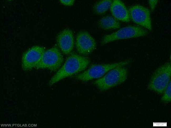 AKT1 Antibody in Immunocytochemistry (ICC/IF)