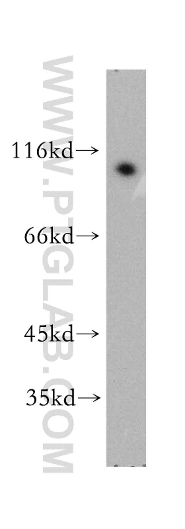 NFKB2 Antibody in Western Blot (WB)