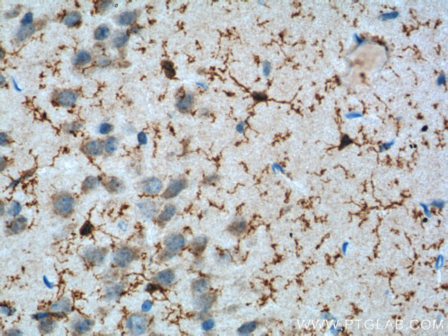 ADORA2A Antibody in Immunohistochemistry (Paraffin) (IHC (P))