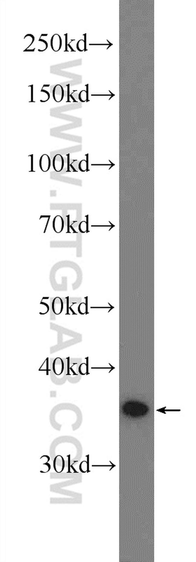 MEK6 Antibody in Western Blot (WB)