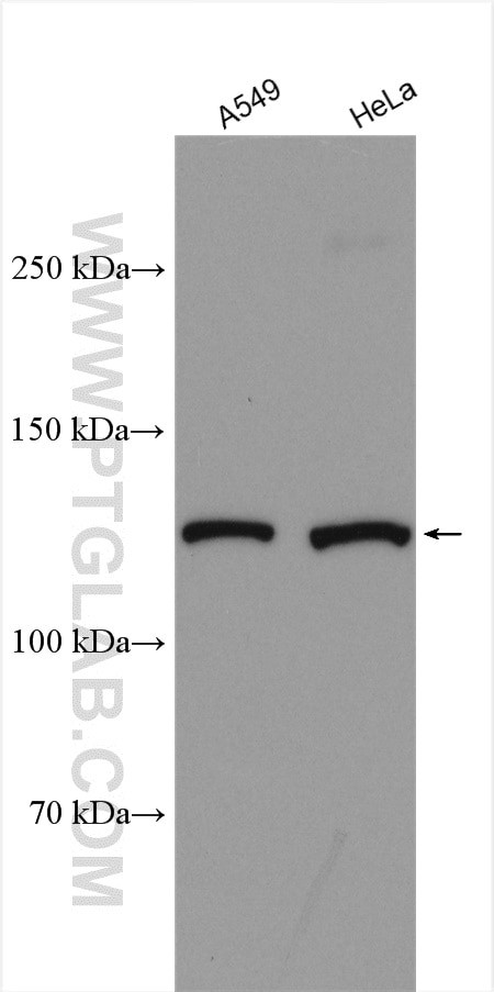 KIAA1033 Antibody in Western Blot (WB)