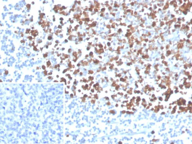 PCNA (Proliferating Cell Nuclear Antigen) (G1- and S-phase Marker) Antibody in Immunohistochemistry (Paraffin) (IHC (P))
