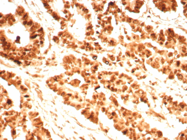 PCNA (Proliferating Cell Nuclear Antigen) (G1- and S-phase Marker) Antibody in Immunohistochemistry (Paraffin) (IHC (P))