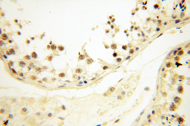 SRC 1 Antibody in Immunohistochemistry (Paraffin) (IHC (P))