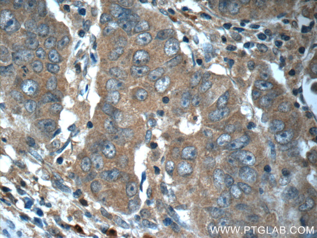 RAF1 Antibody in Immunohistochemistry (Paraffin) (IHC (P))