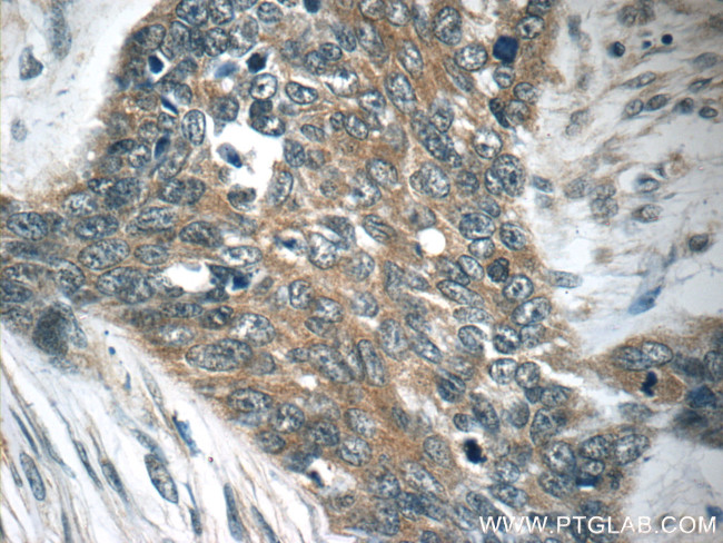 TMPRSS3 Antibody in Immunohistochemistry (Paraffin) (IHC (P))
