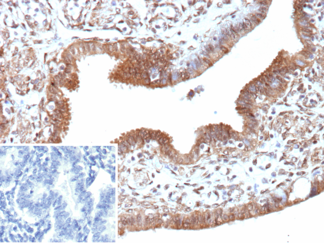 EGFL7 (Tumor Angiogenesis Marker) Antibody in Immunohistochemistry (Paraffin) (IHC (P))