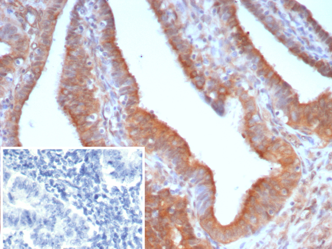 EGFL7 (Tumor Angiogenesis Marker) Antibody in Immunohistochemistry (Paraffin) (IHC (P))