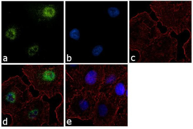 SKP2 Antibody in Immunocytochemistry (ICC/IF)