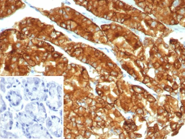 Claudin 18.2 Antibody in Immunohistochemistry (Paraffin) (IHC (P))