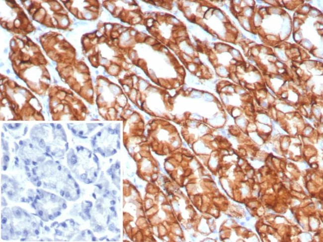 Claudin 18.2 Antibody in Immunohistochemistry (Paraffin) (IHC (P))