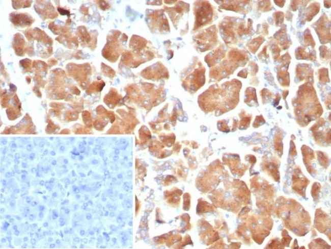 Claudin 18.2 Antibody in Immunohistochemistry (Paraffin) (IHC (P))