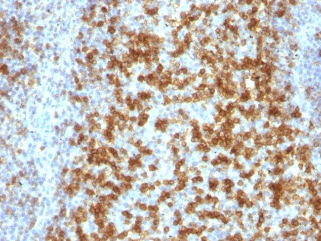 PDCD1/PD1/CD279 (Programmed Cell Death 1) Antibody in Immunohistochemistry (Paraffin) (IHC (P))