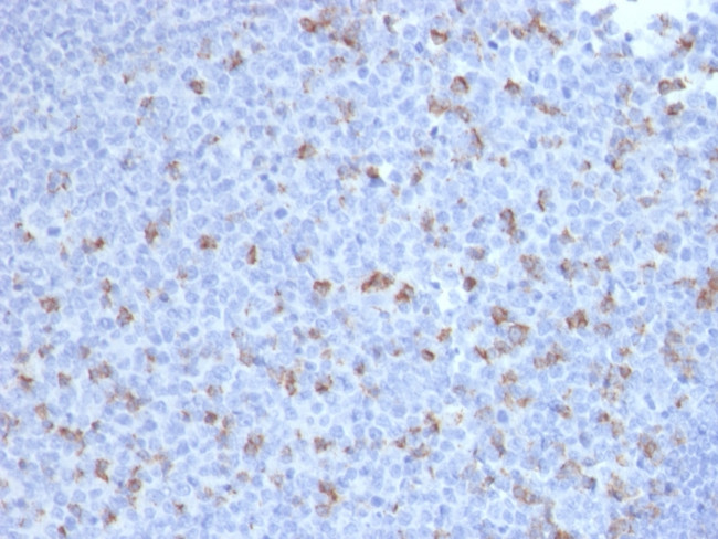 PDCD1/PD1/CD279 (Programmed Cell Death 1) Antibody in Immunohistochemistry (Paraffin) (IHC (P))