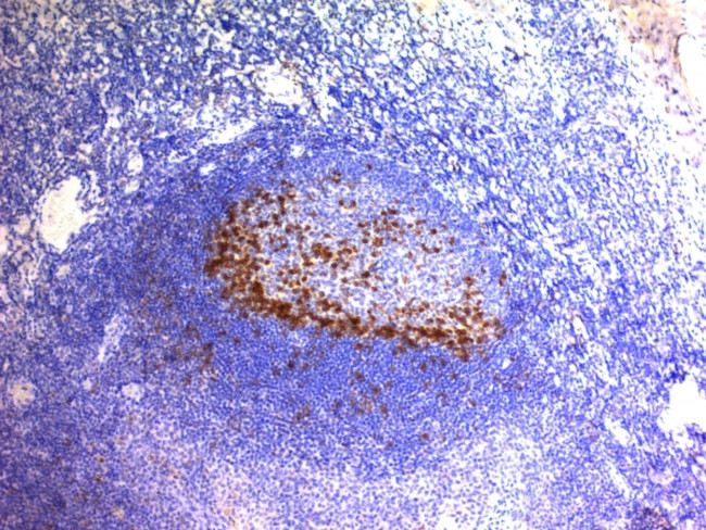 PDCD1/PD1/CD279 (Programmed Cell Death 1) Antibody in Immunohistochemistry (Paraffin) (IHC (P))