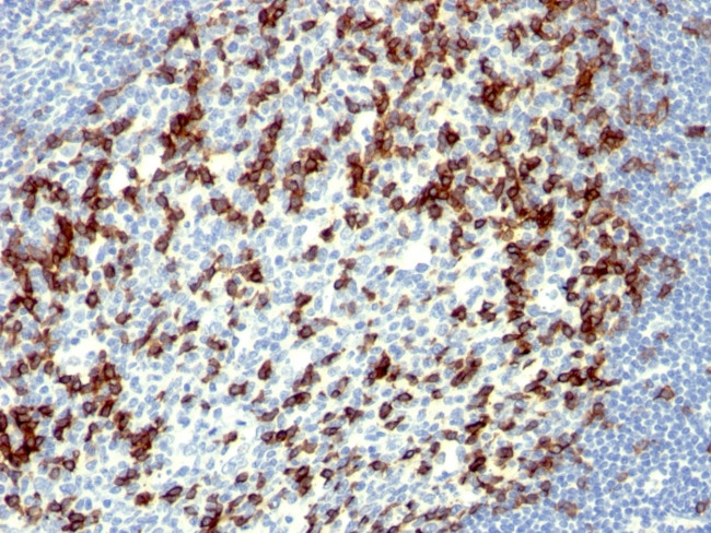 PDCD1/PD1/CD279 (Programmed Cell Death 1) Antibody in Immunohistochemistry (Paraffin) (IHC (P))