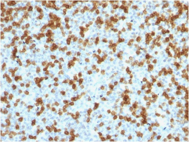 PDCD1/PD1/CD279 (Programmed Cell Death 1) Antibody in Immunohistochemistry (Paraffin) (IHC (P))