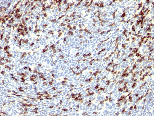 PDCD1/PD1/CD279 (Programmed Cell Death 1) Antibody in Immunohistochemistry (Paraffin) (IHC (P))