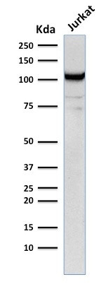 CD31/PECAM-1 (Endothelial Cell Marker) Antibody in Western Blot (WB)