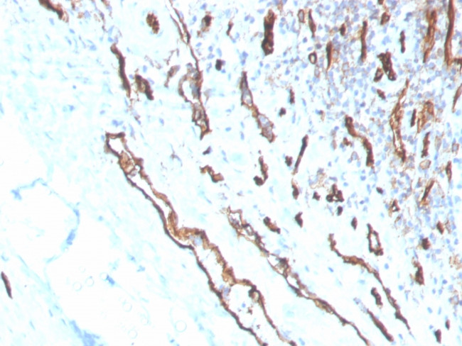CD31/PECAM-1 (Endothelial Cell Marker) Antibody in Immunohistochemistry (Paraffin) (IHC (P))